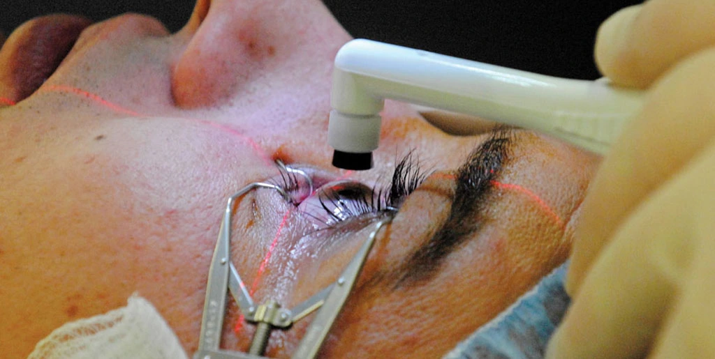 Cataract Surgery Complications to Look Out for