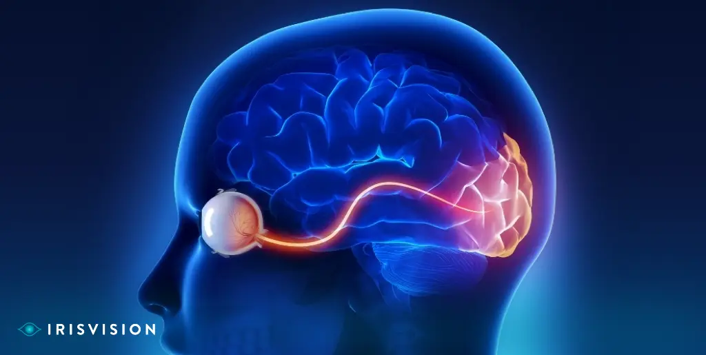 Mitigating the Effects of Optic Nerve Damage and other Eye Conditions?