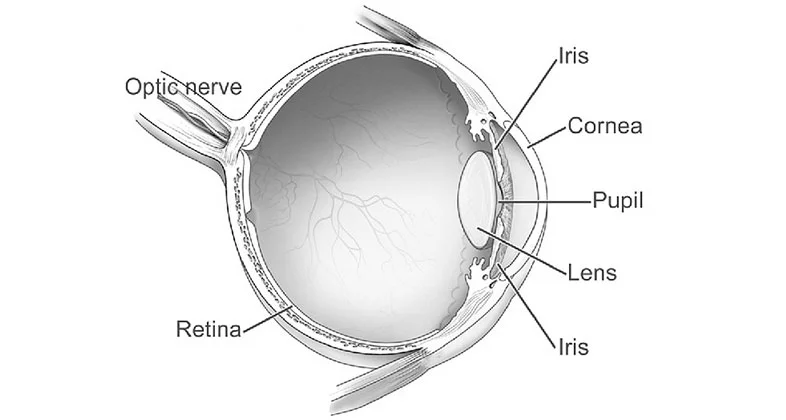 Optic Nerve Damage: Accompanying Eye Diseases & Eye Conditions