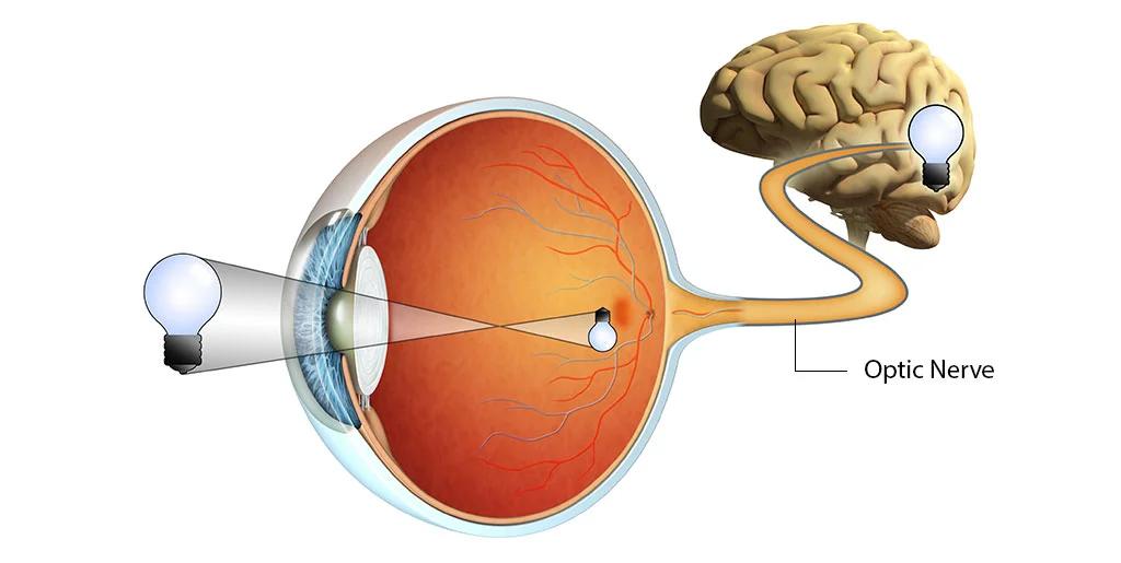retina-optic-nerve-damage-brain