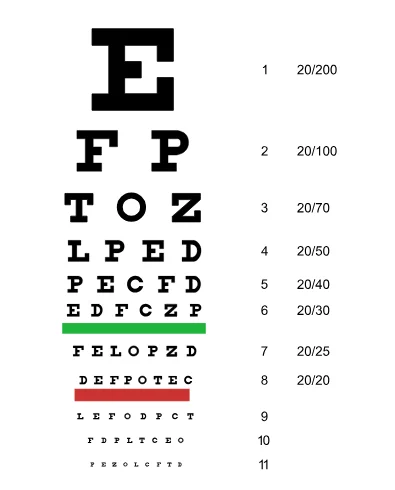 snellen-chart-irisvision