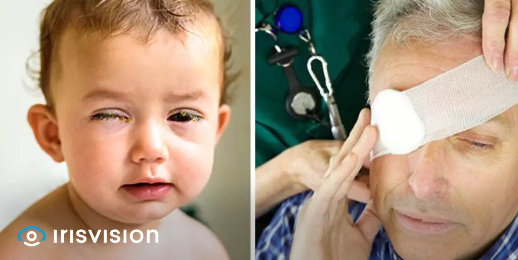 Eye Injury Prevention: Indoors & Outdoors